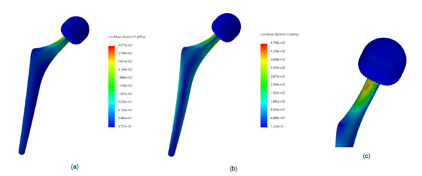 Fig. 2: Results of the preliminary analysis with a thickness of 1 mm. Vertical (a) and horizontal (b) load. The stress on the neck of the stem is evident, at the level of the attachment with the spherical head (c). This may require analysis with more densely packed discretization.
