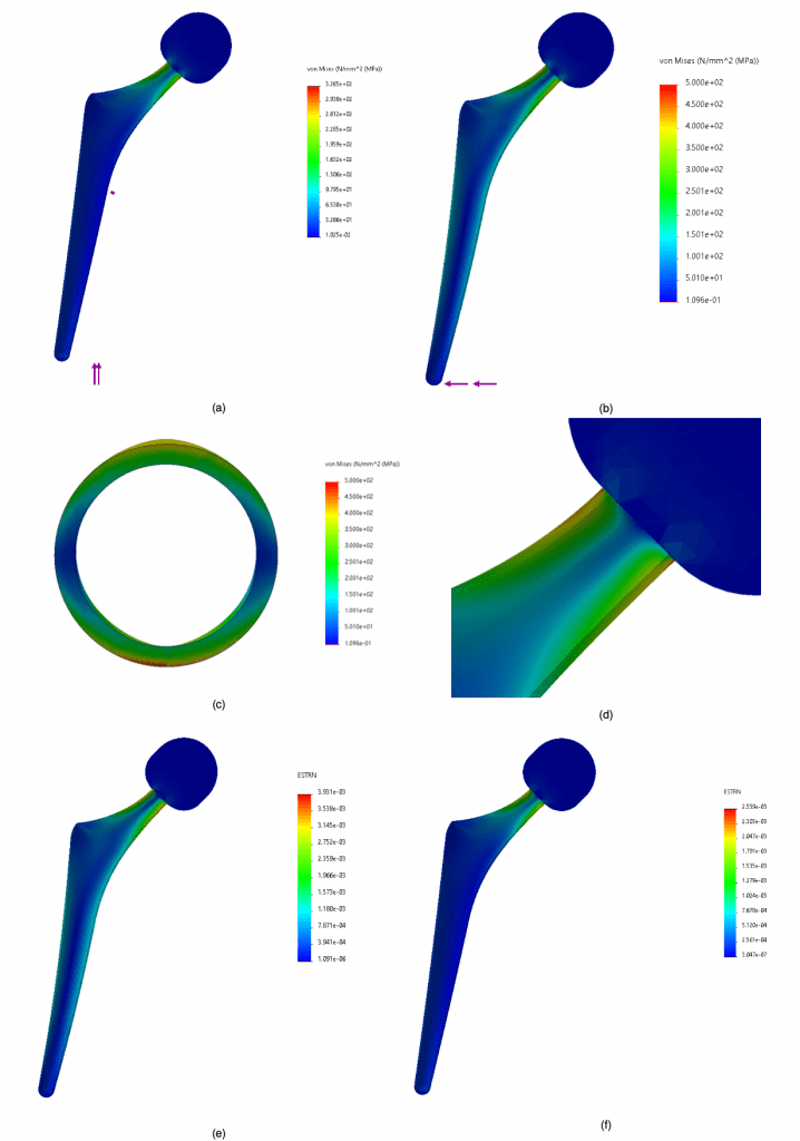 Fig. 4: Final confirmatory analysis with 1.01mm thickness and vertical (a) and horizontal (b) load. Section of the stem-head attachment area in the case of greater stress (horizontal load), the area most heavily loaded is the lower part (c). Zoom on the area of maximum strain (d). Strain in the case of vertical (e) and horizontal (f) load.