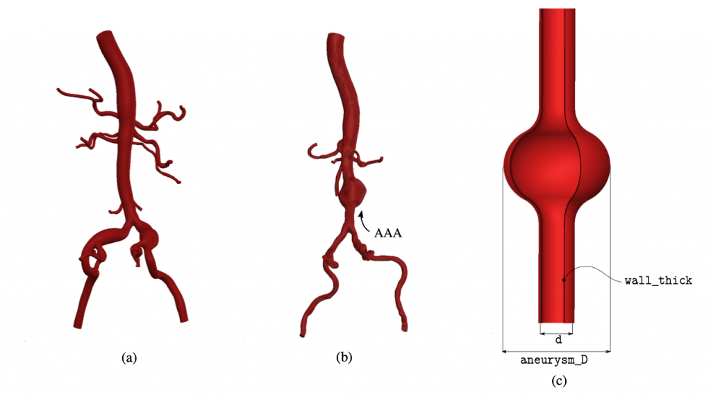 FIG. 1: Ricostruzione 3D dell’aorta (a) e dell’aorta aneurismatica (b)[3]. Approssimazione geometrica dell’anueurisma utilizzata per l’analisi strutturale, il dominio interno è stato invece utilizzato per l’analisi CFD (c)