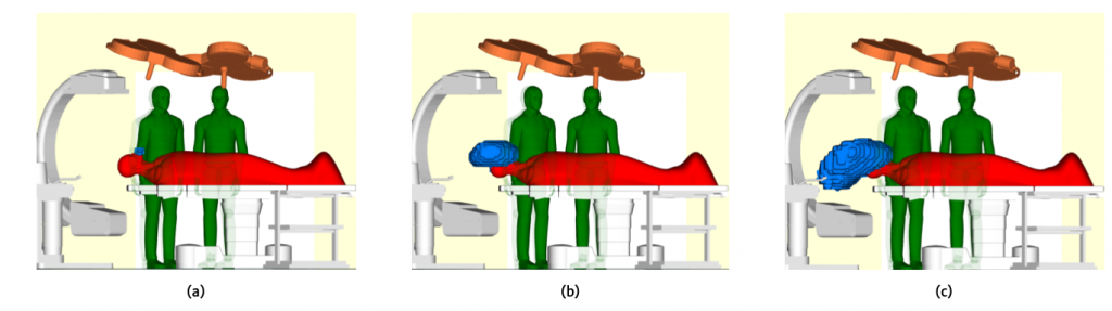 Fig. 14. Flusso d’aria contaminata (in azzurro) in uscita dal paziente simulando un colpo di tosse (prolungato) a 0.1 secondi (a), 2 secondi (b) e 4 secondi (c). Il continuo flusso d’aria unidirezionale imposto dalla superficie di ingresso tende ad allontanare l’aria contaminata dall’equipe chirurgica e a spingerla verso il basso, quindi verso le bocchette di aspirazione.